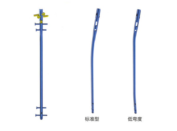 胫骨髓内钉